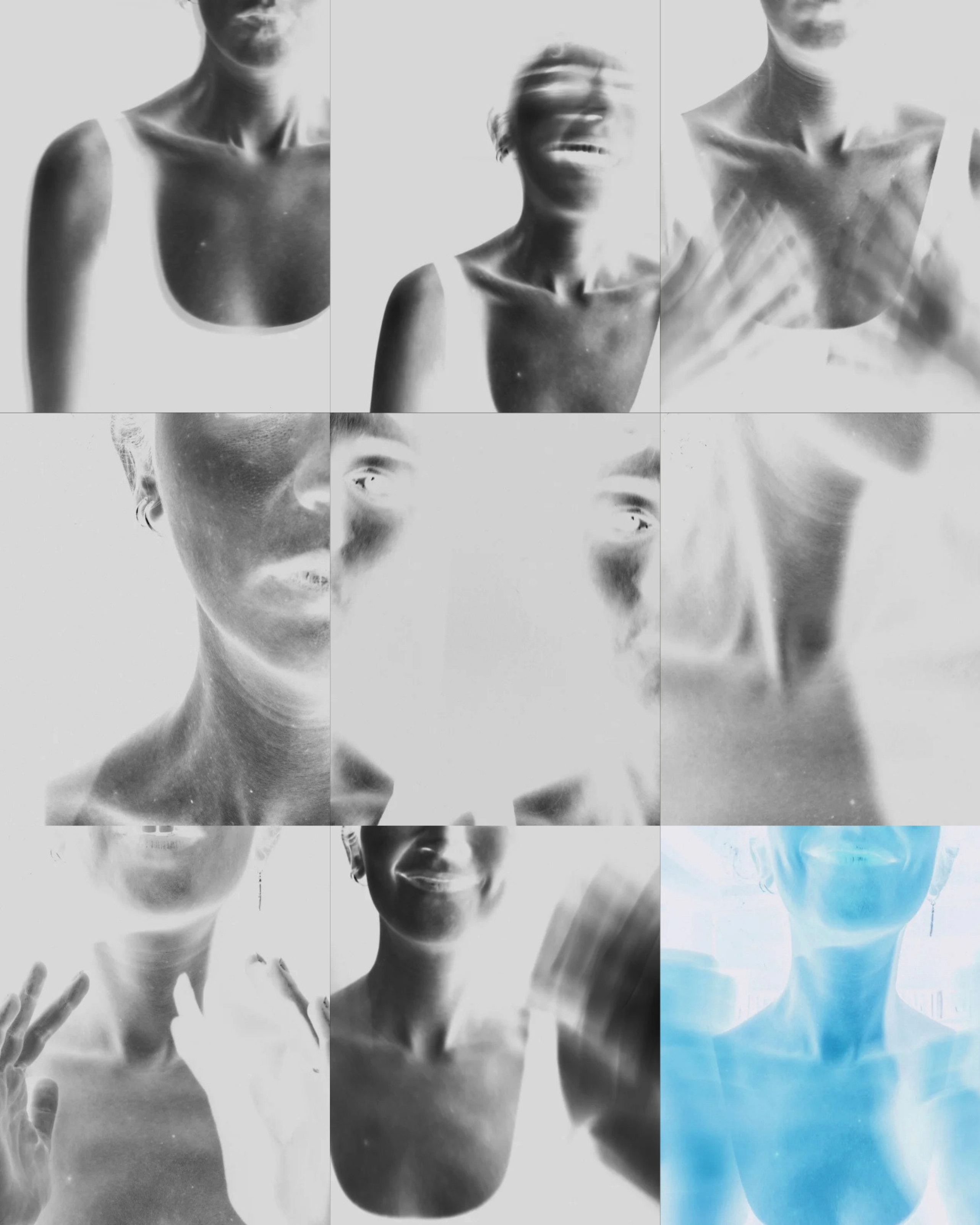 Emotional X-ray - Manolya İzgi Gezgin